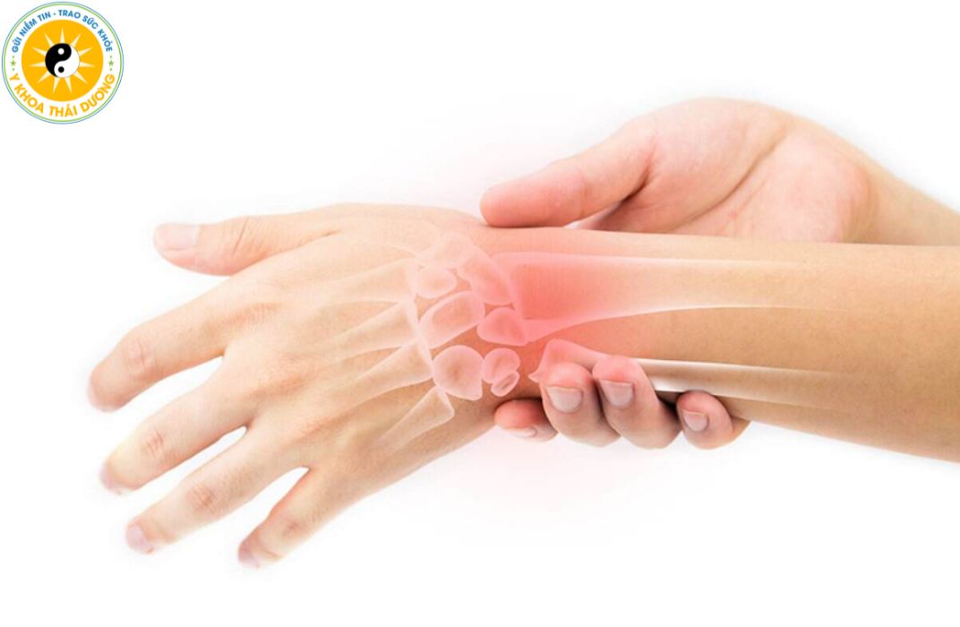 Viêm gân: Làm sao để điều trị dứt điểm và tránh tái phát?