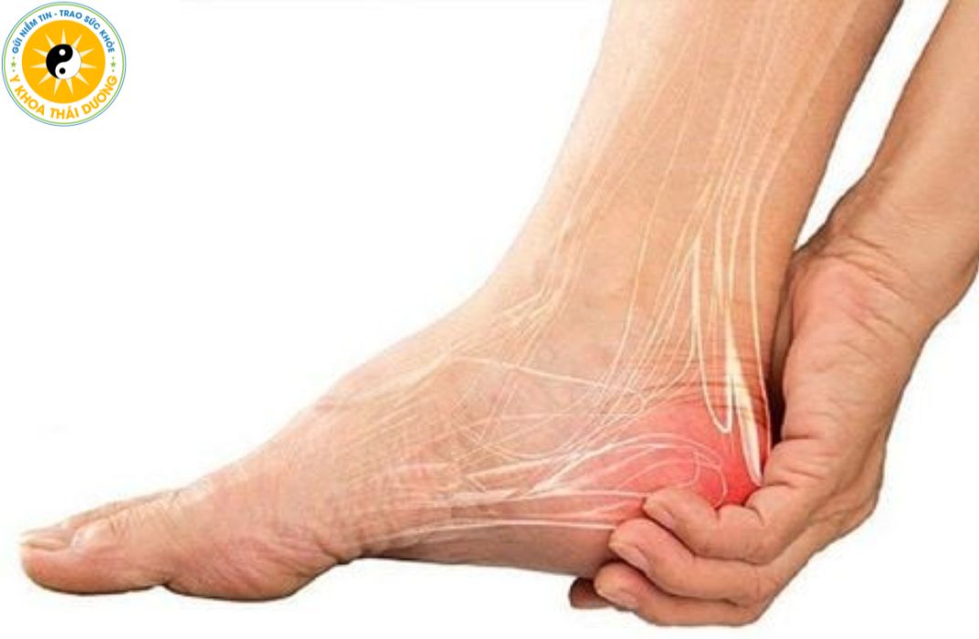 Viêm gân: Nguyên nhân, triệu chứng và phương pháp điều trị