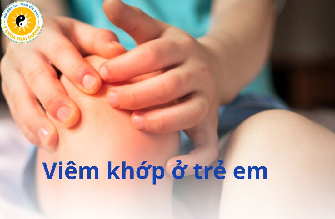 Viêm khớp ở trẻ em có nguy hiểm không? Dấu hiệu cảnh báo và hướng điều trị sớm