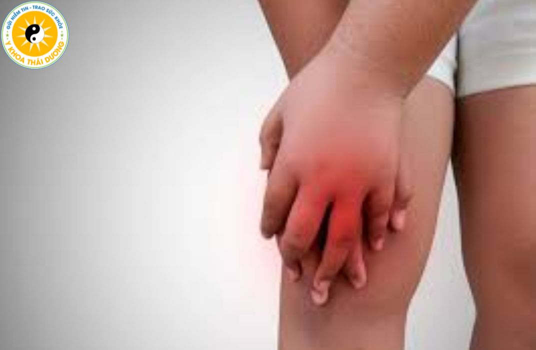 Viêm khớp ở trẻ em có nguy hiểm không? 