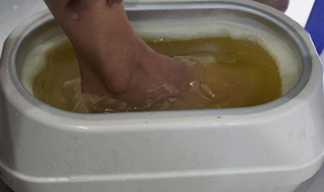 nhúng sáp trị liệu