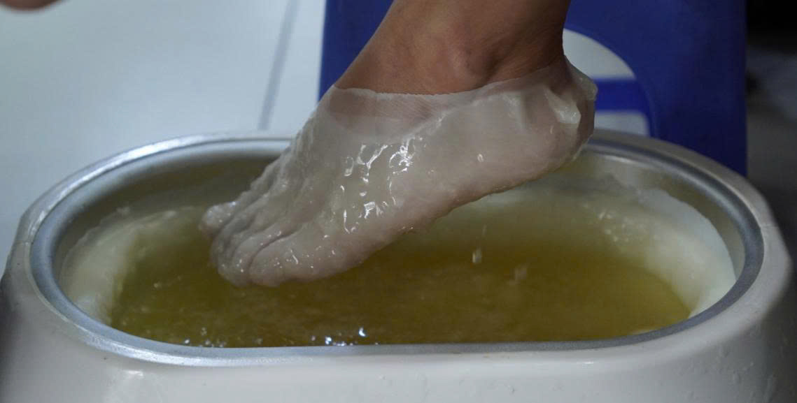 Nhúng Sáp Trị Liệu - Liệu Pháp Giảm Đau, Cải Thiện Cuộc Sống 2 nhúng sáp parafin